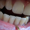 1526a62dcb924e727fd6aec0cb217b7b7df269ed_thumb